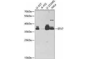 Western blot analysis of extracts of various cell lines, using ETV7 antibody (ABIN6132177, ABIN6140336, ABIN6140338 and ABIN6221858) at 1:1000 dilution. (ETV7 antibody  (AA 1-210))