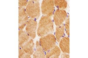B staining GCLM in human skeletal muscle tissue sections by Immunohistochemistry (IHC-P - paraformaldehyde-fixed, paraffin-embedded sections). (GCLM antibody  (C-Term))