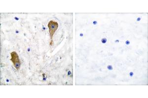Peptide - +Immunohistochemical analysis of paraffin-embedded human brain tissue using GAD67 antibody. (GAD antibody)