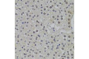 Immunohistochemistry of paraffin-embedded mouse liver using HNRNPA1 Antibody (ABIN5975570) at dilution of 1/100 (40x lens). (HNRNPA1 antibody)