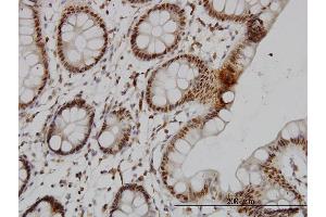 Immunoperoxidase of monoclonal antibody to STK17B on formalin-fixed paraffin-embedded human colon.