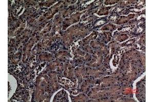 Immunohistochemistry (IHC) analysis of paraffin-embedded Human Kidney, antibody was diluted at 1:100. (ZNF227 antibody  (Internal Region))