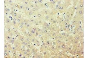 Immunohistochemistry of paraffin-embedded human liver tissue using ABIN7143588 at dilution of 1:100