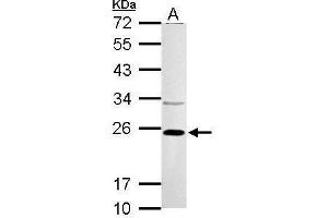 VHL antibody