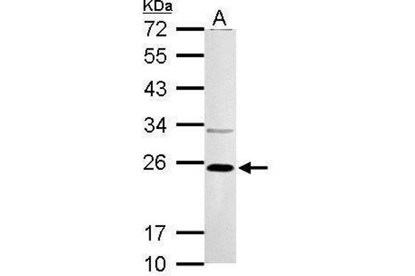 VHL antibody