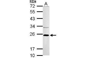 WB Image VHL antibody detects VHL protein by Western blot analysis.