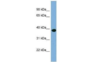 WB Suggested Anti-OAS1 Antibody Titration:  0. (OAS1 antibody  (N-Term))