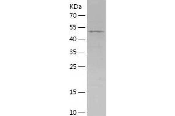 GCLC Protein (AA 1-218) (His-IF2DI Tag)
