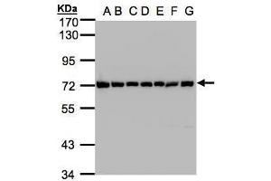 WB Image Sample(30μg whole cell lyaste) A: 293T B: A431 , C: H1299 D: HeLa S3 , E: Hep G2 , F: MOLT4 , G: Raji , 7. (HSP70 1A antibody  (Center))