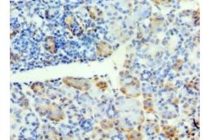 Immunohistochemistry of paraffin-embedded human pancreatic tissue using ABIN7171159 at dilution of 1:100 (SYT4 antibody  (AA 38-190))