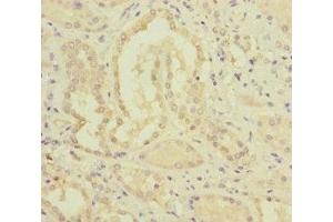 Immunohistochemistry of paraffin-embedded human kidney tissue using ABIN7159656 at dilution of 1:100 (MMACHC antibody  (AA 63-282))