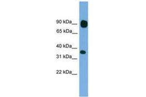 Image no. 1 for anti-Protocadherin beta 15 (PCDHB15) (AA 35-84) antibody (ABIN6744858) (PCDHB15 antibody  (AA 35-84))