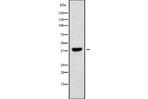 Western blot analysis of MAGAA using RAW264. (MAGEA10 antibody  (Internal Region))