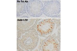 Immunohistochemistry (IHC) image for anti-Interleukin 10 (IL10) antibody (ABIN6254177) (IL-10 antibody)