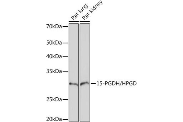 HPGD 抗体