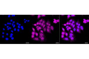 Immunocytochemical staining of HepG2 cells with BAG cochaperone 3 antibody (ABIN7800911), 1:1,000).