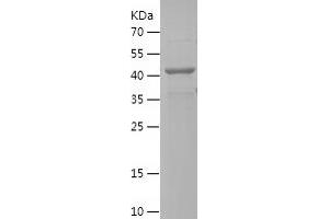 Western Blotting (WB) image for Elongator Acetyltransferase Complex Subunit 4 (ELP4) (AA 26-259) protein (His-IF2DI Tag) (ABIN7283741) (ELP4 Protein (AA 26-259) (His-IF2DI Tag))