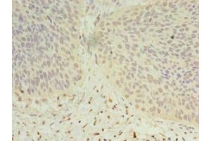 Immunohistochemistry (IHC) image for anti-Dehydrogenase/reductase (SDR Family) Member 12 (DHRS12) (AA 1-271) antibody (ABIN7149610)