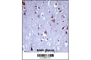 Immunohistochemistry (IHC) image for anti-Potassium Voltage-Gated Channel, Shaw-Related Subfamily, Member 1 (KCNC1) (AA 479-508), (C-Term) antibody (ABIN5534634)