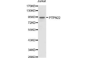 PTPN22 anticorps  (AA 1-90)
