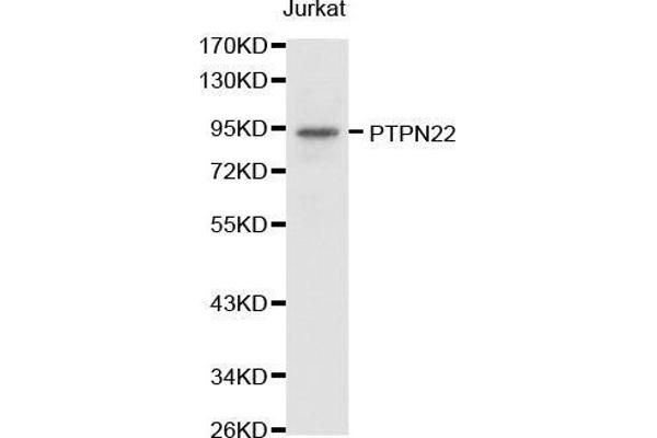 PTPN22 抗体  (AA 1-90)