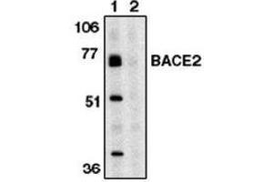 Image no. 1 for anti-beta-Site APP-Cleaving Enzyme 2 (BACE2) (AA 496-511) antibody (ABIN264997) (BACE2 antibody  (AA 496-511))