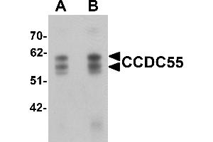 Western blot analysis of CCDC55 in human brain tissue lysate with CCDC55 antibody at (A) 0.