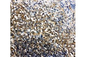 IHC-P: Bid antibody testing of rat spleen tissue (BID antibody  (C-Term))