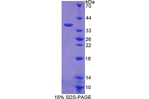 SDS-PAGE analysis of Mouse RELA Protein. (NF-kB p65 Protein)