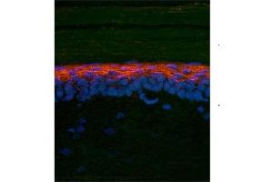 rat and mouse brain (SMAD2 antibody  (N-Term))