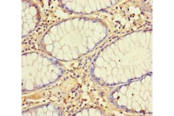MRPL21 antibody  (AA 40-205)
