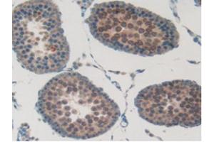 IHC-P analysis of Rat Testis Tissue, with DAB staining. (SFTPB antibody  (AA 111-329))