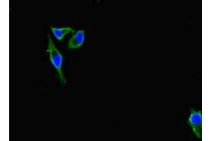 Immunofluorescent analysis of Hela cells using ABIN7156691 at dilution of 1:100 and Alexa Fluor 488-congugated AffiniPure Goat Anti-Rabbit IgG(H+L) (IFITM5 antibody  (AA 1-36))