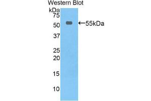 Western Blotting (WB) image for anti-Thymidine Phosphorylase (TYMP) (AA 33-290) antibody (ABIN3207502) (Thymidine Phosphorylase antibody  (AA 33-290))