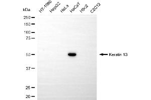 Western blotting analysis using keratin 13 antibody (ABIN7799166).