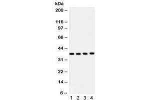 Western blot testing of 1) human placenta, 2) HeLa, 3) HUT and 4) Jurkat lysate with PINX1 antibody. (PINX1 antibody)