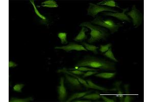 Immunofluorescence of purified MaxPab antibody to TRIM35 on HeLa cell. (TRIM35 antibody  (AA 1-493))