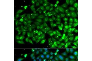 Immunofluorescence analysis of A549 cells using SH3GLB1 Polyclonal Antibody