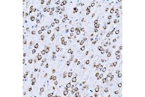 IHC analysis of VPRBP/DCAF1 using anti-VPRBP/DCAF1 antibody (ABIN7602005). (DDB1 and CUL4-Associated Factor 1 (DCAF1) (AA 540-861) antibody)