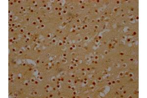 IHC image of ABIN7127452 diluted at 1:100 and staining in paraffin-embedded human brain tissue performed on a Leica BondTM system. (Recombinant DDX6 antibody)