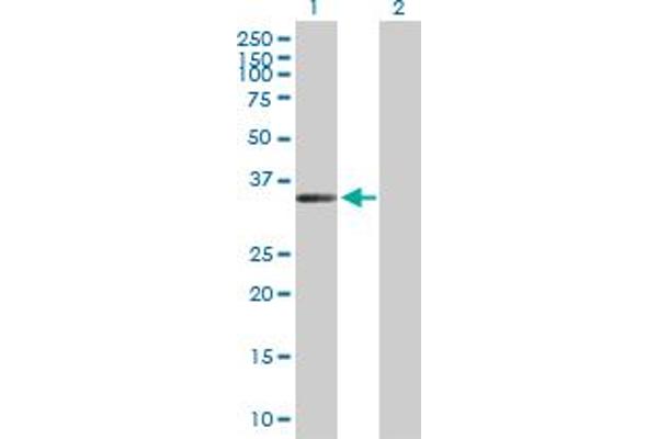 ZC3H14 antibody  (AA 1-306)