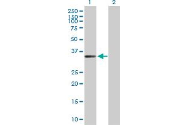 ZC3H14 anticorps  (AA 1-306)