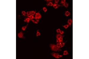 ABIN6275256 staining COLO205 by IF/ICC. (MEGF9 antibody  (Internal Region))