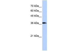 Western Blotting (WB) image for anti-ATPase, H+ Transporting, Lysosomal 38kDa, V0 Subunit D2 (ATP6V0D2) antibody (ABIN2459920)