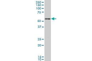 PRPF19 monoclonal antibody (M07), clone 2E5. (PRP19 antibody  (AA 1-90))