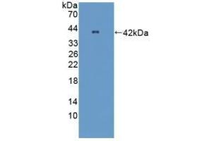 Detection of Recombinant OPTN, Mouse using Polyclonal Antibody to Optineurin (OPTN)
