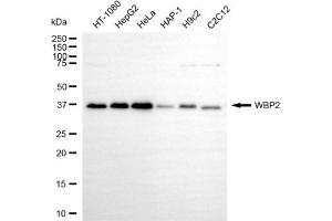 Western blotting analysis using WBP2 antibody (ABIN7800868).