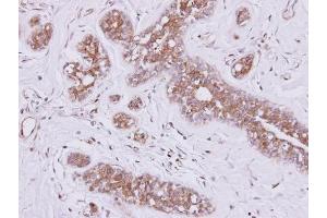 IHC-P Image Immunohistochemical analysis of paraffin-embedded SAOS-2 xenograft, using FSD2, antibody at 1:500 dilution. (FSD2 antibody  (N-Term))