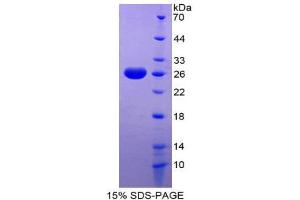 SDS-PAGE (SDS) image for GATA Binding Protein 2 (GATA2) (AA 117-338) protein (His tag) (ABIN2124936)