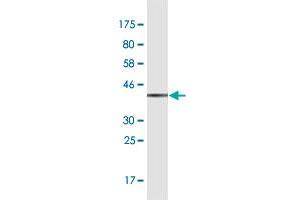 Western Blot detection against Immunogen (37. (GBF1 antibody  (AA 101-209))